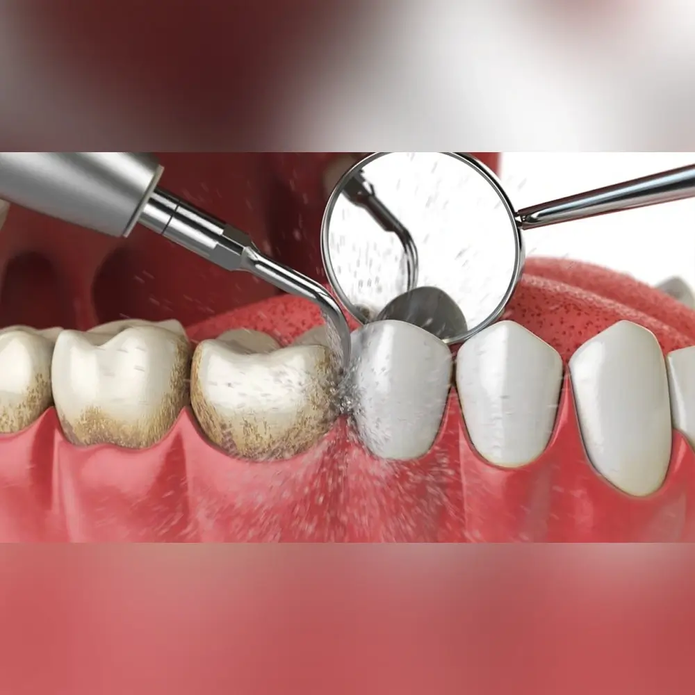 clips_and_braces
