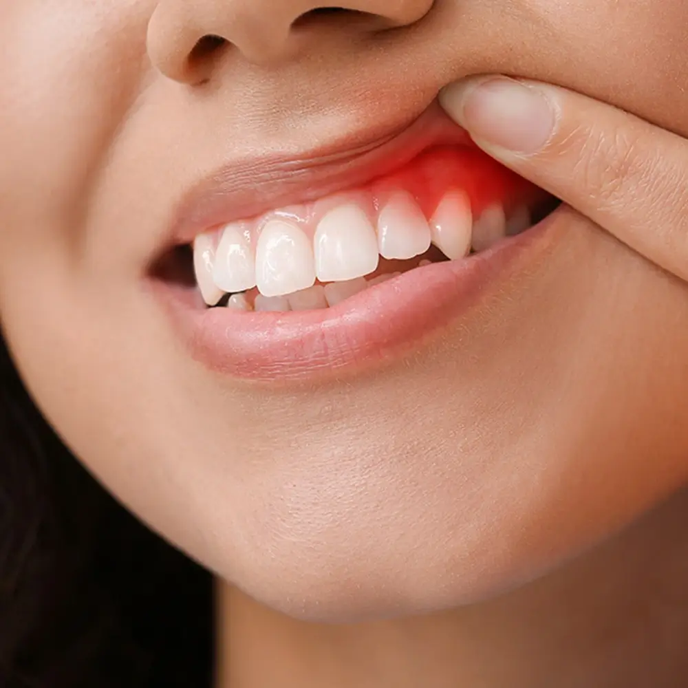 clips_and_braces