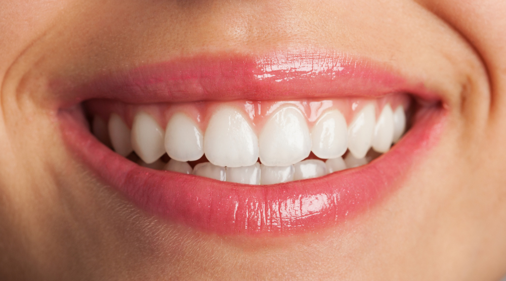 Digital Smile Design The Future of Cosmetic Dentistry